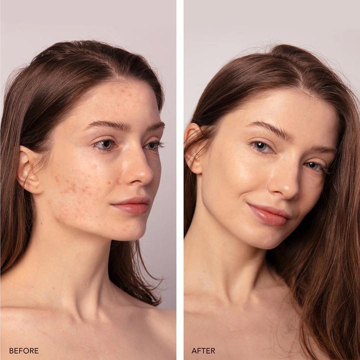 Actual product image Foreo ESPADA 2 plus Pistachio