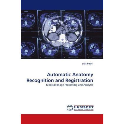 Automatic Anatomy Recognition and Registration, Fachbücher von Ulas Bagci