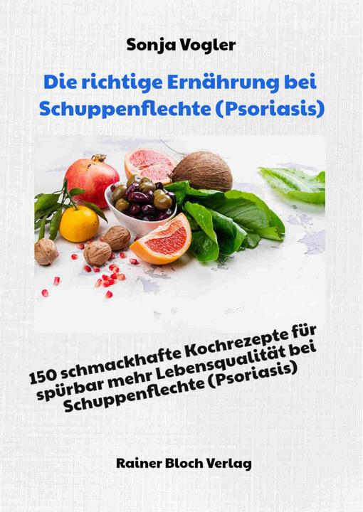 Produktbild Vogler:Die richtige Ernährung bei Schup (Deutsch, Sonja Vogler)