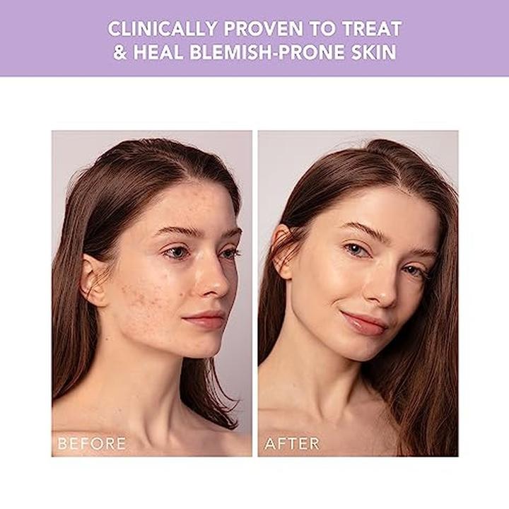 Actual product image Foreo ESPADA 2 plus Lavender