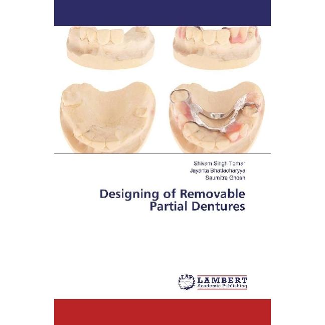 Designing of Removable Partial Dentures, Fachbücher von Jayanta Bhattacharyya, Shivam Singh Tomar, Saumitra Ghosh