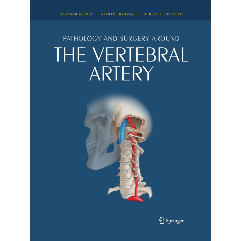 Pathology and surgery around the vertebral artery, Fachbücher von Bernard George, Michaël Bruneau
