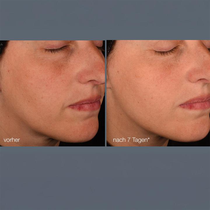 Produktbild Dermalogica Pro-Collagen (30 ml)