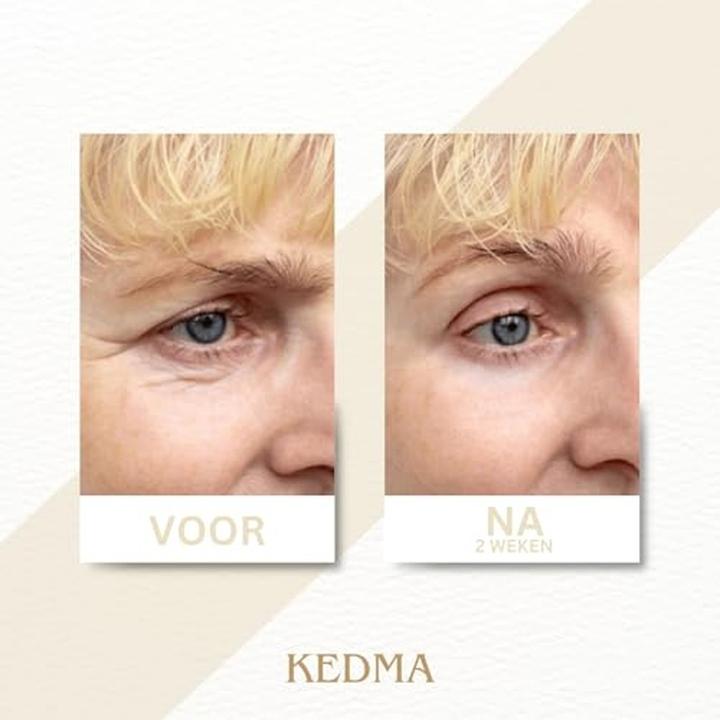 Actual product image Kedma Lifting Serum (50 ml)