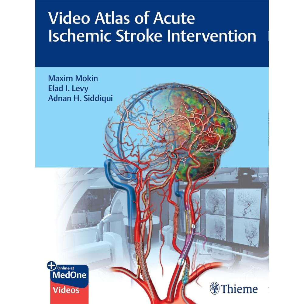 Mokin:Video Atlas of Acute Ischemic Str, Fachbücher von Adnan H. Siddiqui, Maxim Mokin, Elad Levy