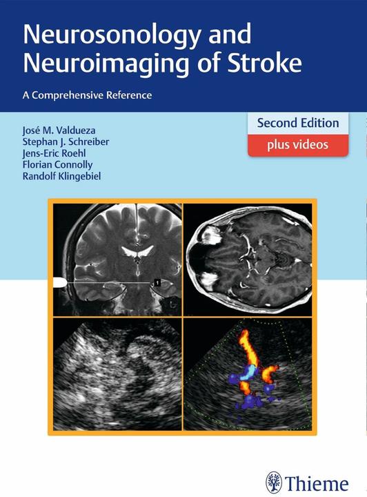 Produktbild Neurosonology and Neuroimaging of Stroke (Englisch, Florian Connolly, Jens-Eric Röhl, José Manuel Valdueza, Randolf Klingebiel, Stephan Schreiber, 2016)