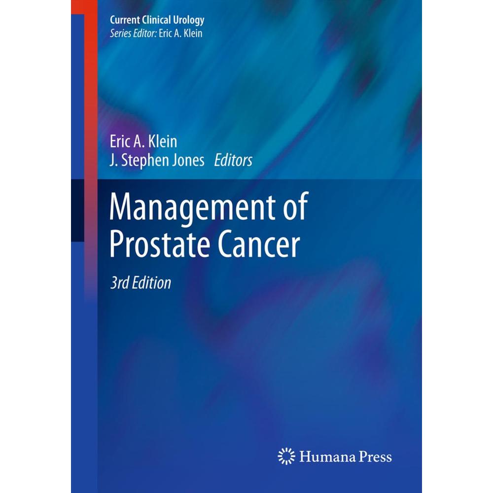Management of Prostate Cancer, Fachbücher von J. Stephen Jones, Eric A. Klein