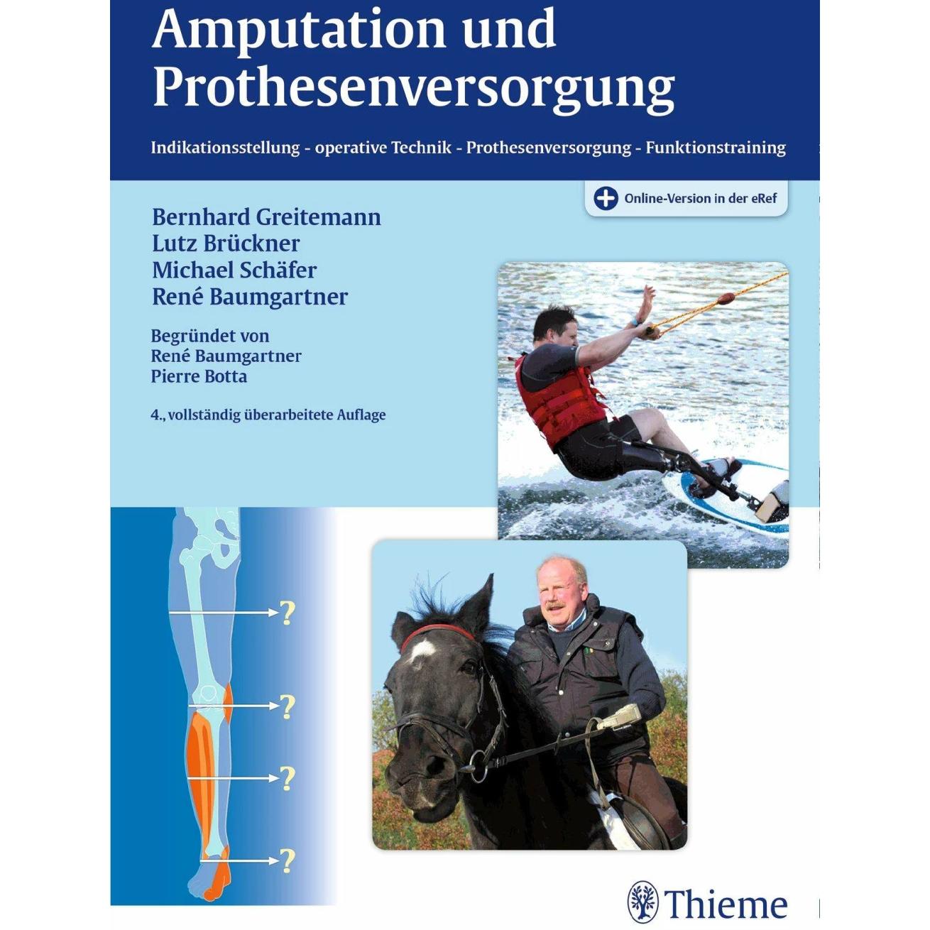 Thumbnail - Amputation und Prothesenversorgung, Fachbücher von René Baumgartner, Michael Schäfer, Bernhard Greitemann, Lutz Brückner