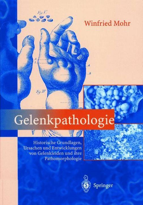 Produktbild Gelenkpathologie (Deutsch, R. Endres-Klein, Winfried Mohr, 2013)
