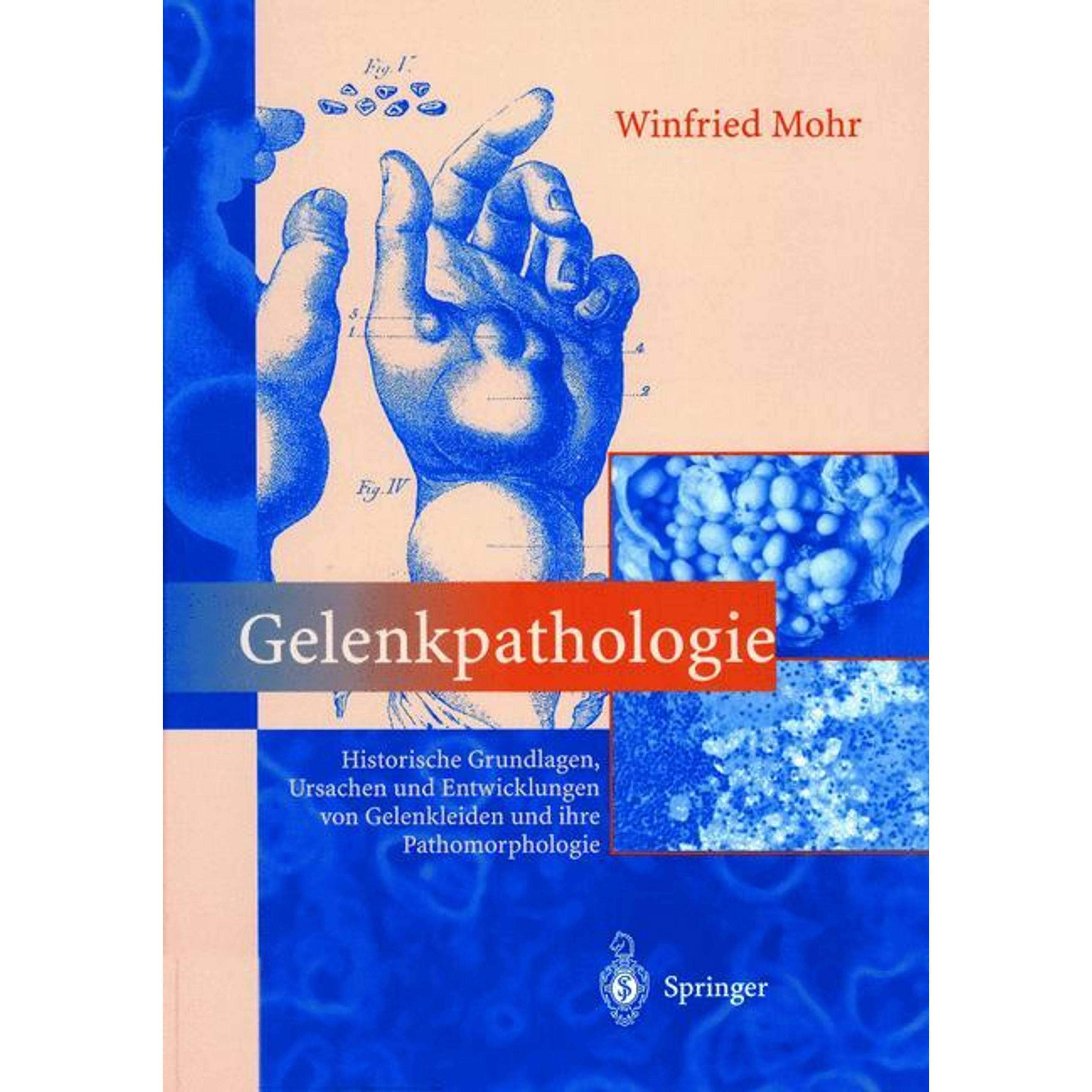 Gelenkpathologie, Fachbücher von Winfried Mohr