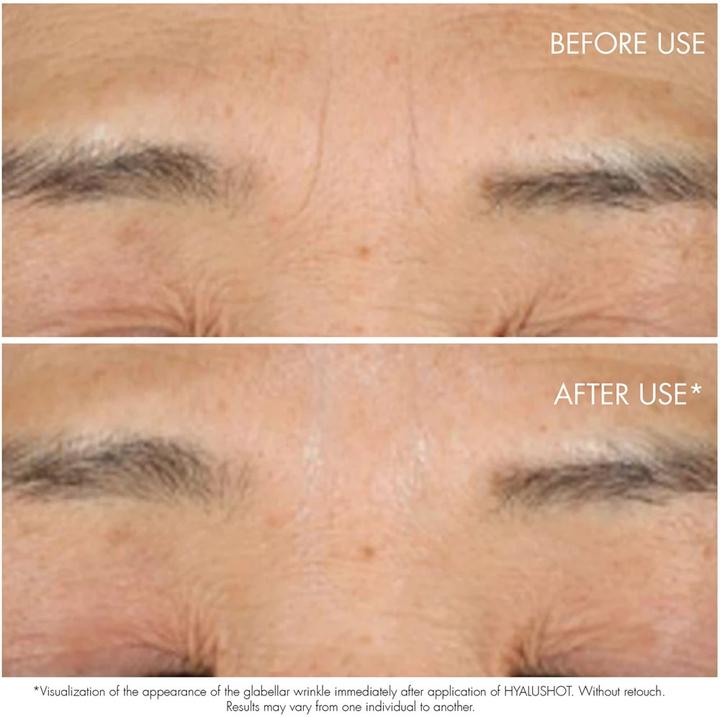 Image du produit Dior Hyalushot Concentre (Soin des yeux Sérum, Jour + nuit, 15 ml)