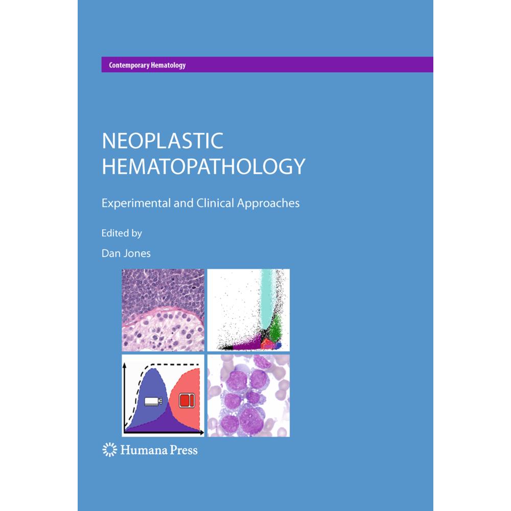 Neoplastic Hematopathology, Fachbücher von Dan Jones