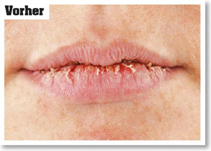 Actual product image O'Keeffe's Lip Repair Unscented Lip Balm (Lip Care Stick)