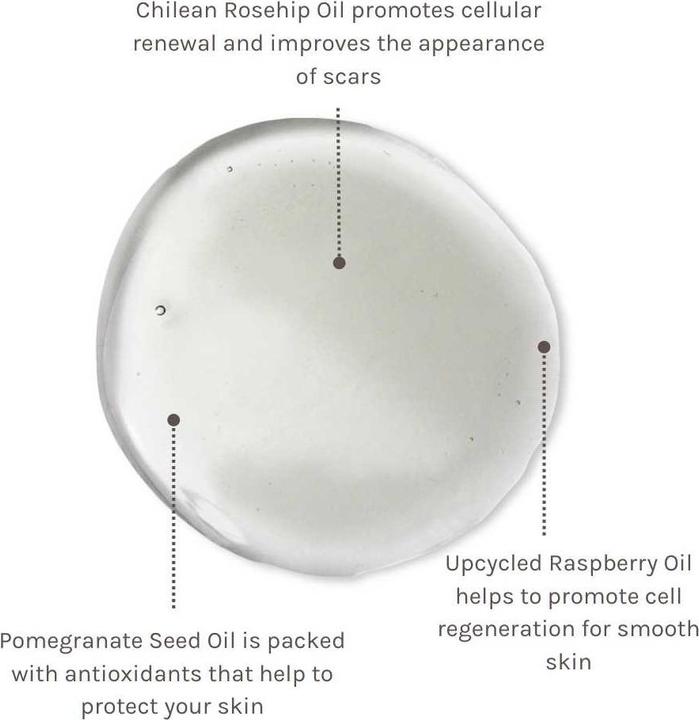 Produktbild Evolve Beauty Super Berry Natural Body Oil for Scars and Stretch Marks 100ml (Körperöl, 100 ml)