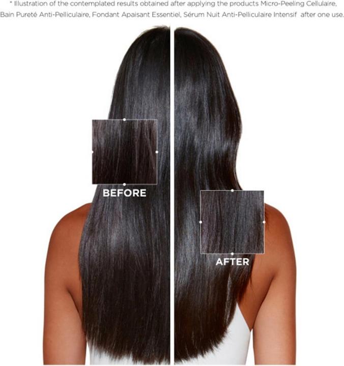 Produktbild Kérastase Symbiose Bain Pureté Anti-Pelliculaire (250 ml, Flüssiges Shampoo)