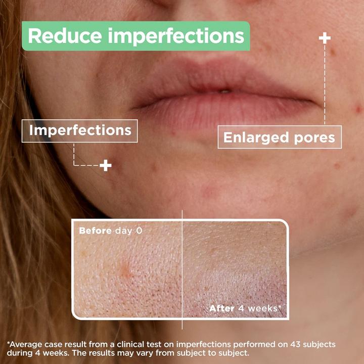 Produktbild Mixa Anti-Imperfection (30 ml)