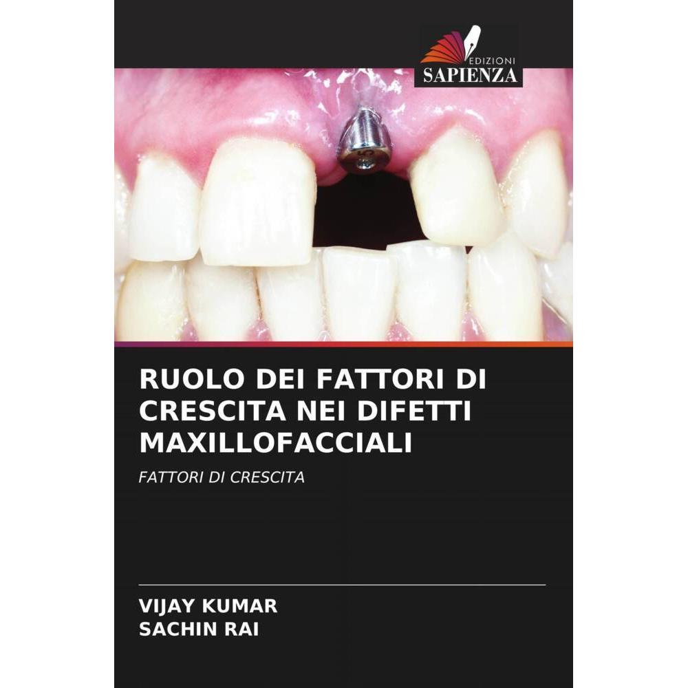 Ruolo Dei Fattori Di Crescita Nei Difetti Maxillofacciali, Fachbücher von Vijay Kumar, SACHIN RAI