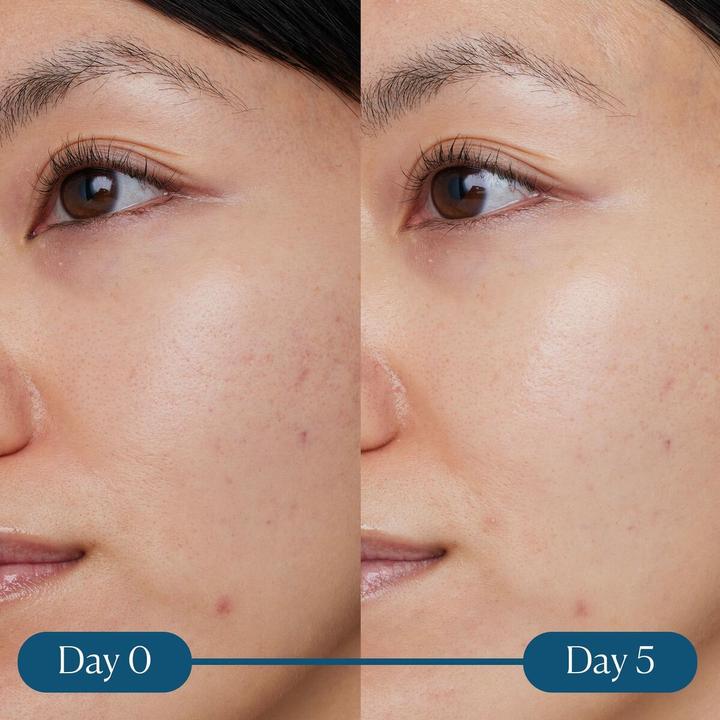 Produktbild Elemis ELEMIS Dynamic Resurfacing Super-C Serum serum do twarzy z witaminą C 30ml (30 ml)