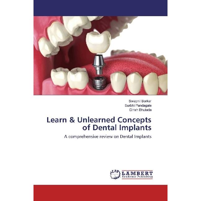 Learn & Unlearned Concepts of Dental Implants, Fachbücher von Swapnil Borkar, Surbhi Pandagale, Girish Bhutada