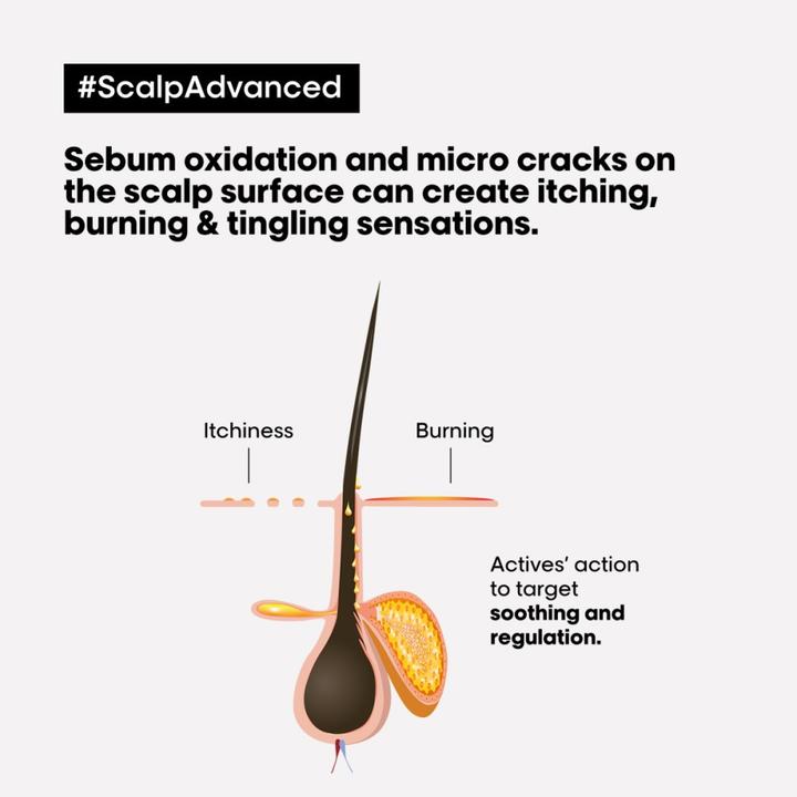 Actual product image L'Oréal Professionnel Série Expert Scalp Advanced - Anti-Discomfort Dermo-Regulator (300 ml, Liquid shampoo)