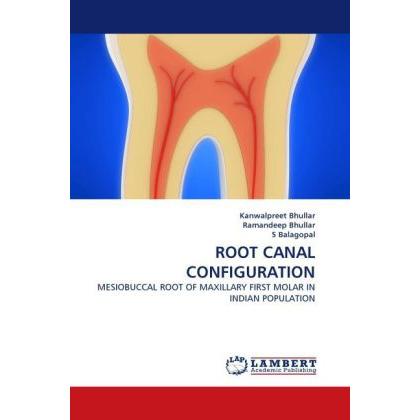 Thumbnail - Root Canal Configuration, Fachbücher von Ramandeep Bhullar, Kanwalpreet Bhullar, S Balagopal