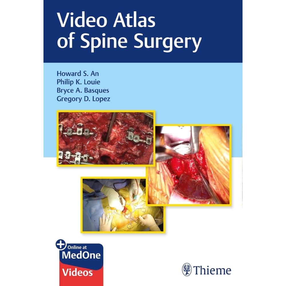 Video Atlas of Spine Surgery, Fachbücher von Gregory Lopez, Howard S. An, Bryce Basques, Philip K. Louie