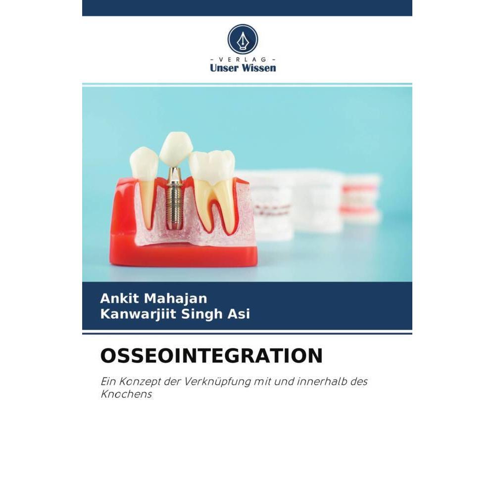Osseointegration, Fachbücher von Kanwarjiit Singh Asi, Ankit Mahajan