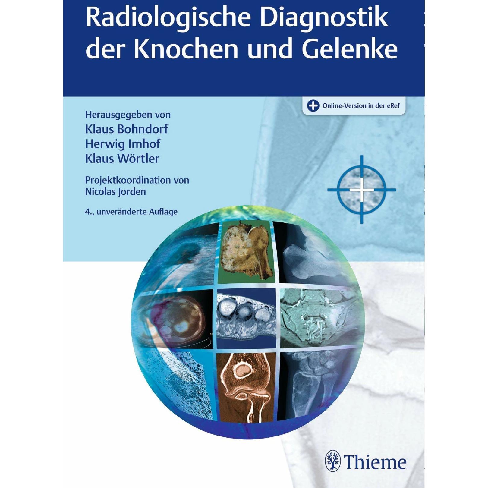 Radiologische Diagnostik der Knochen und Gelenke, Fachbücher von Herwig Imhof, Klaus Bohndorf, Klaus Wörtler