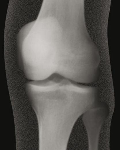 Produktbild Roylco Röntgenbilder Mensch