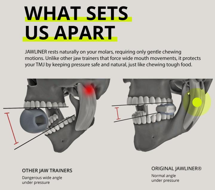 Actual product image Jawliner Expert Jaw
