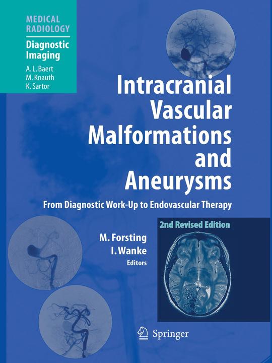 Produktbild Intracranial Vascular Malformations and Aneurysms (Englisch, 2010)