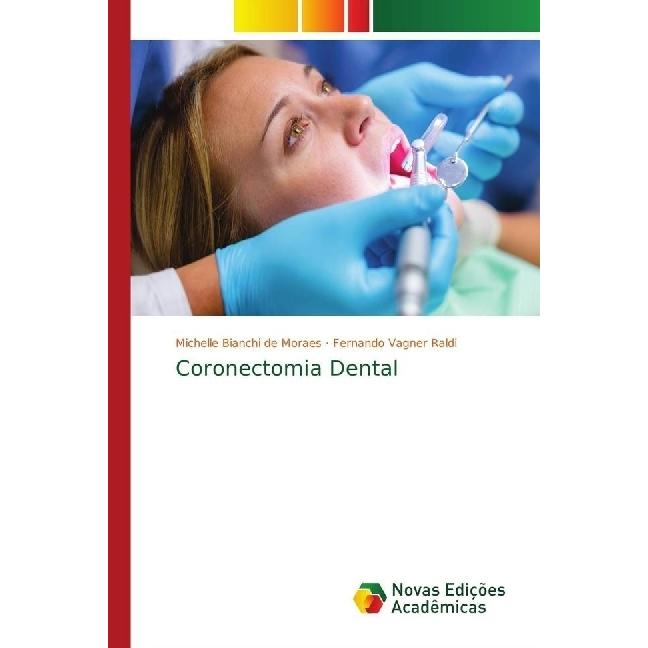 Coronectomia Dental, Fachbücher von Michelle Bianchi de Moraes, Fernando Vagner Raldi