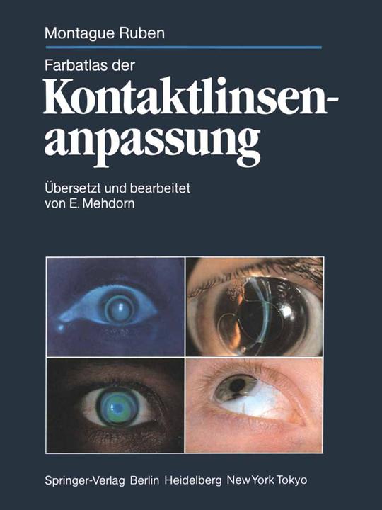 Produktbild Farbatlas der Kontaktlinsenanpassung (Deutsch, Montague Ruben, 2011)