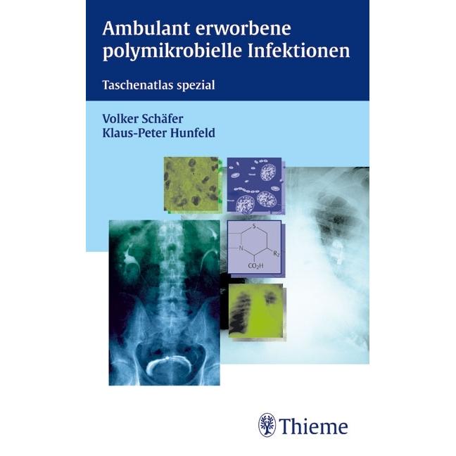 Ambulant erworbene polymikrobielle Infektionen, Fachbücher von Volker Schäfer, Klaus-Peter Hunfeld