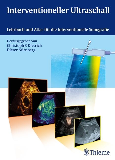 Produktbild Interventioneller Ultraschall (Deutsch, Christoph Frank Dietrich, Dieter Nürnberg, 2011)