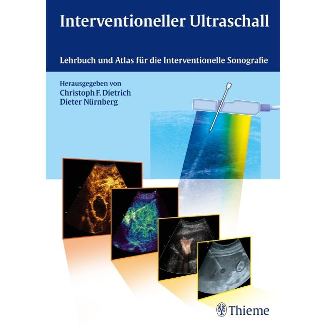 Thumbnail - Interventioneller Ultraschall, Fachbücher von Dieter Nürnberg, Christoph Frank Dietrich