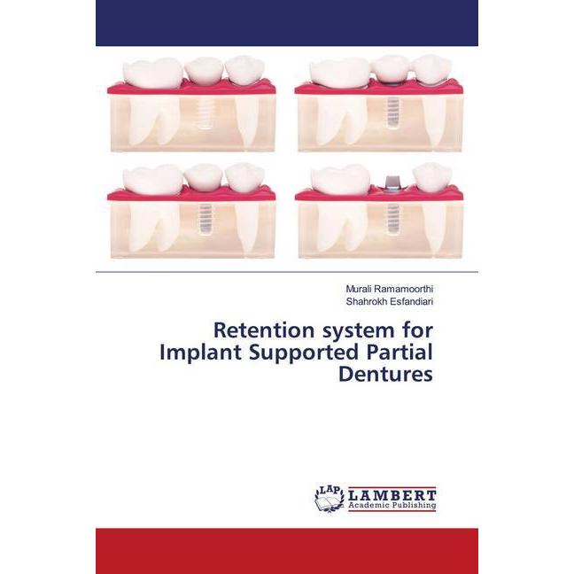 Retention system for Implant Supported Partial Dentures, Fachbücher von Shahrokh Esfandiari, Murali Ramamoorthi