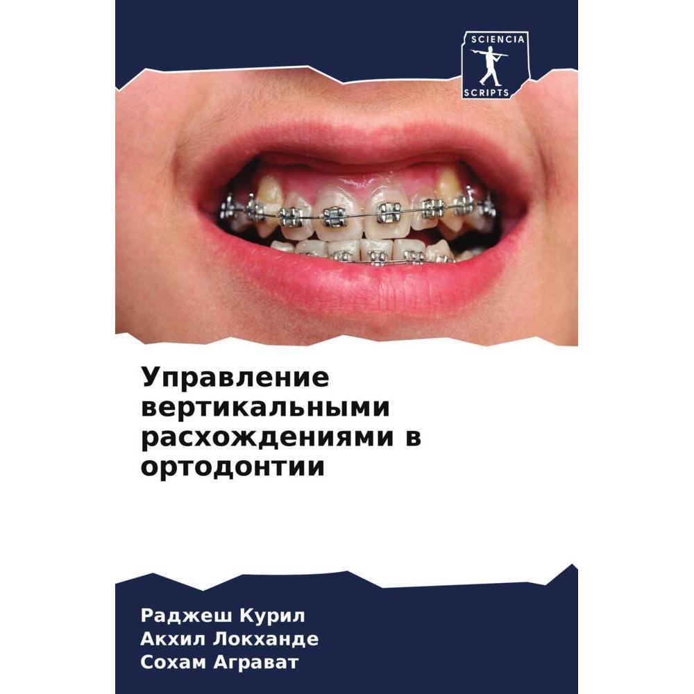 Uprawlenie wertikal'nymi rashozhdeniqmi w ortodontii, Fachbücher von Radzhesh Kuril, Soham Agrawat, Akhil Lokhande