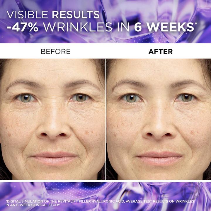 Actual product image L'Oréal Paris Revitalift Filler Set Hautpflege-Geschenkset (Facial care set)