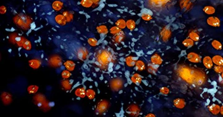 Actual product image Bresser Mikrocam II 9MP 4K 1 Microscope camera