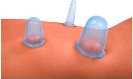 Immagine prodotto Fispo Testa di coppettazione in silicone, diametro 5 cm