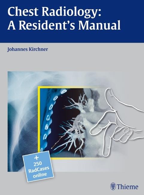 Produktbild Chest Radiology: A Resident's Manual (Englisch, Johannes Kirchner, 2011)