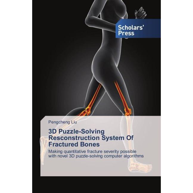 3D Puzzle-Solving Resconstruction System Of Fractured Bones, Fachbücher von Pengcheng Liu