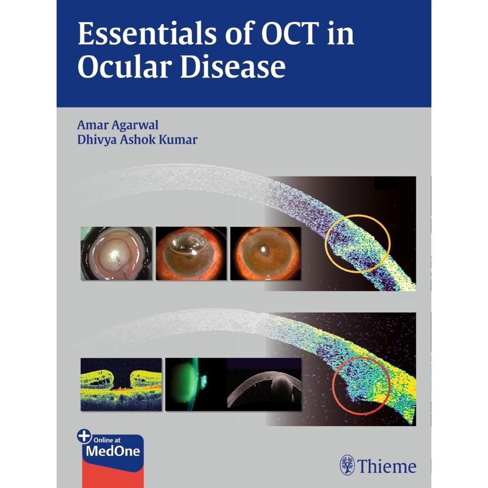 Agarwal:Essentials of OCT in Ocular Di, Sachbücher von Amar Agarwal