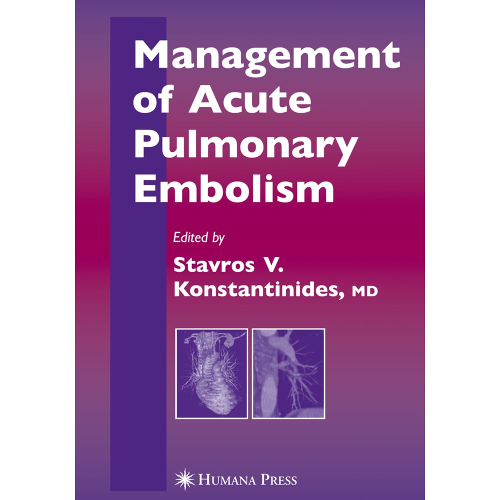 Management of Acute Pulmonary Embolism, Fachbücher von Stavros V. Konstantinides