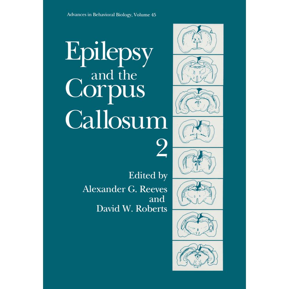 Epilepsy and the Corpus Callosum 2, Fachbücher von David W. Roberts, Alexander G. Reeves