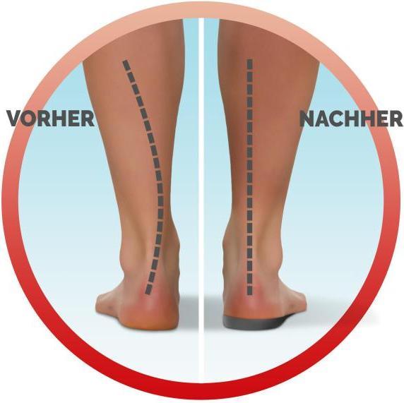 Actual product image Scholl In-Balance ¾ insoles for pain from knee to heel