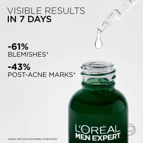 Actual product image L'Oréal Paris Men Expert Derma Control Anti-Blemish Serum (30 ml)