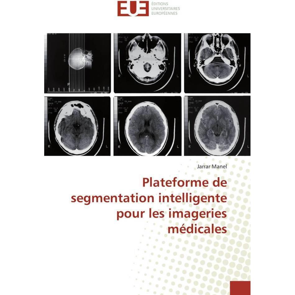 Plateforme de segmentation intelligente pour les imageries médicales, Fachbücher von Jarrar Manel