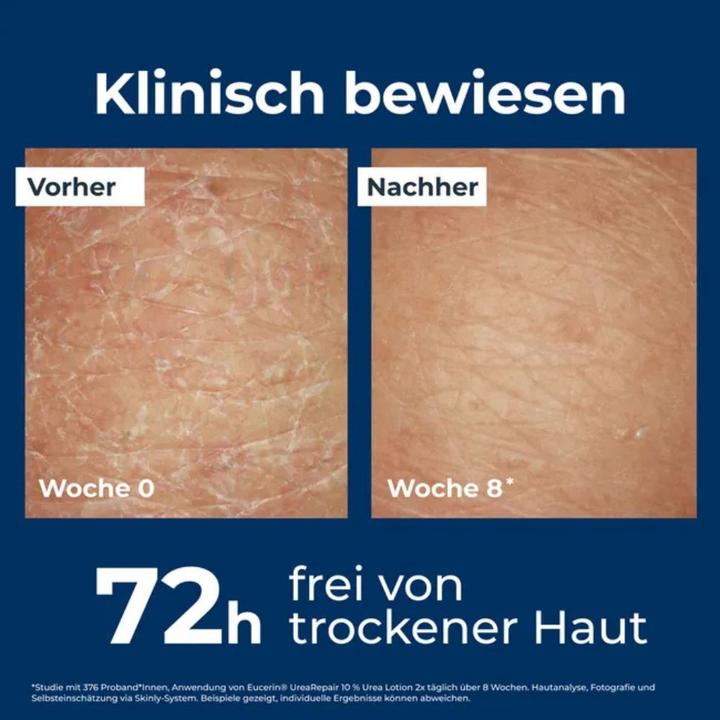 Image du produit Eucerin Urée Repair 10% Intensive (Lait pour le corps, 400 ml)